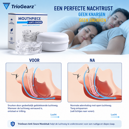 Anti-Snurk Mondbeschermer – Comfortabele Beugel tegen Snurken & Tandenknarsen